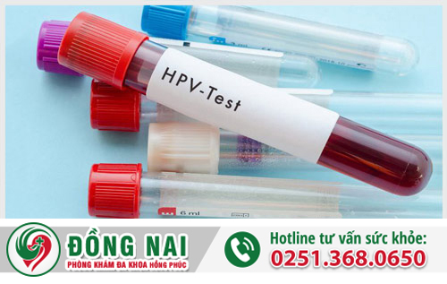 Xét nghiệm HPV âm tính là bị sùi mào gà hay không?